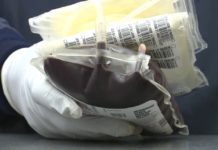 The ADVANCE study still seeking more participants – WUSA9.com