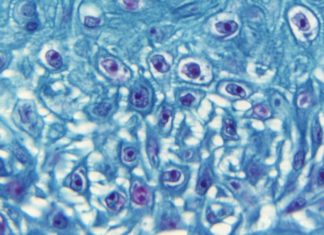 WHO convenes experts to decide if monkeypox is an emergency – The Seattle Times