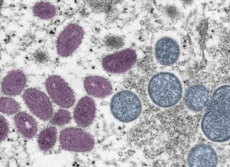 WHO Says Monkeypox Isn’t A Global Health Emergency Yet—But Raises ‘Serious Concerns’ About Spread – Forbes