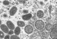 4 more Sacramento County monkeypox cases reported. Here’s who should get vaccinated – KCRA Sacramento