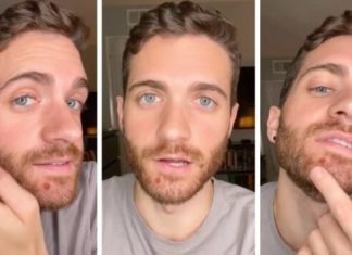 Gay man with monkeypox reveals symptoms and lesions in viral video – Queerty