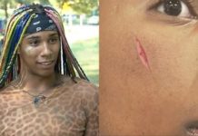 Gay Men Targeted in Homophobic NYC Attack Speak Out – Yahoo News