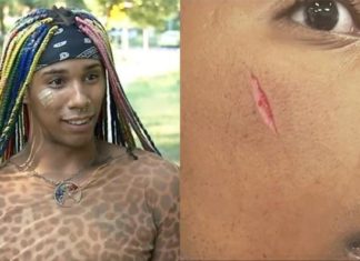 Gay Men Targeted in Homophobic NYC Attack Speak Out – Yahoo News