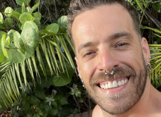 He loved his Florida trip. Then the monkeypox blisters appeared. – POZ