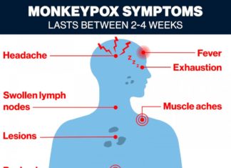 Monkeypox cases up 77% in 1 week: WHO – ABC News
