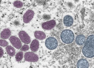 Monkeypox Likely to Have Spread During SF Pride; 16 Total Cases In the City As of Last Week – SFist