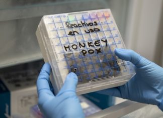 Monkeypox spreads in L.A., but vaccine shortage persists – Los Angeles Times