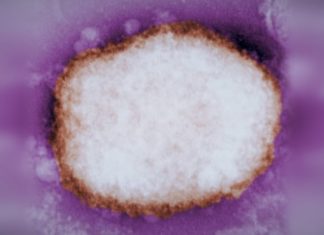 Monkeypox vaccines to be offered at Vancouver bathhouses as 21 cases confirmed in B.C. – CBC.ca