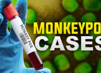Oregon reports at least 6 monkeypox cases, says info, testing, vaccine and treatment are key in response – KTVZ
