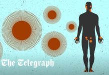 UK monkeypox vaccine rollout ‘too slow’ as cases surpass 1700 – The Telegraph