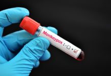 US stumbles in monkeypox response – WJTV
