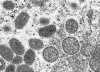 42 new cases of monkeypox diagnosed in Massachusetts in past week, DPH says – WCVB Boston