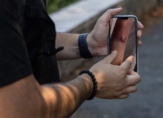 A health equity expert on making monkeypox messaging more inclusive – STAT