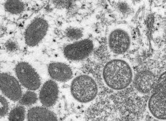 Africa CDC says gay sex ‘not relevant’ in monkeypox there – ABC News