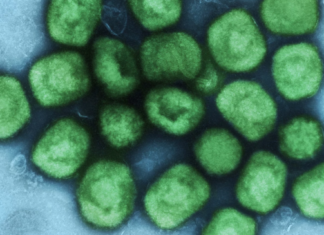 Austin officials expect more doses of the monkeypox vaccine after U.S. declares a health emergency – Austin Monitor