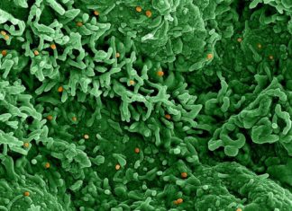 COVID Sewage Surveillance Labs Join the Hunt for Monkeypox – KQED