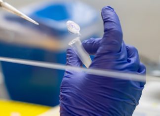 Cuyahoga County monkeypox cases top 60, with the majority in Cleveland, officials say – WKSU News