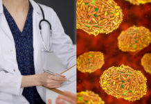 Expert Q&A: What You Need To Know About Monkeypox – Science Friday