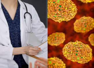 Expert Q&A: What You Need To Know About Monkeypox – Science Friday