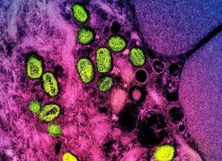 Gay, and bisexual men changing sexual behavior to reduce risk of monkeypox – News-Medical.Net