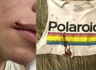 Gay Couple Attacked in Shaw, Called “Monkeypox F*****s” – Metro Weekly