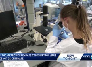 Health care providers warn that monkeypox does not discriminate amid rising cases – KCCI Des Moines