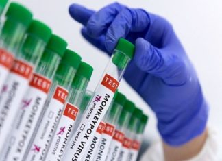 Health News Roundup: African monkeypox cases not concentrated among gay men, experts say; Cigna boosts forecast as lower costs drive profit beat and more – Devdiscourse