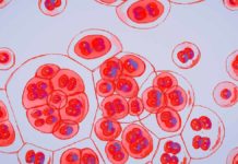 HIV diagnoses are the lowest in Australia since the 1980s – Cosmos