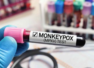 LifeBridge Health Turns to Digital Health to Track Monkeypox Cases – HealthLeaders Media