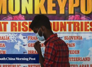Monkeypox isn’t a ‘gay disease’ – South China Morning Post