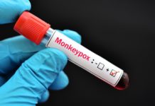 Monkeypox Outbreak: Testing, Vaccines, and More – Johns Hopkins Bloomberg School of Public Health