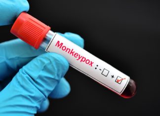 Monkeypox Outbreak: Testing, Vaccines, and More – Johns Hopkins Bloomberg School of Public Health
