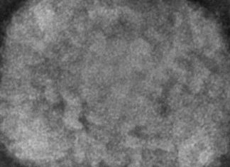 Orange County reports 1st monkeypox case in person under 18 – Spectrum News 1