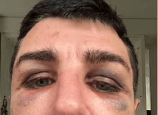 ‘They wanted to kill me’: Police plead for help as gay artist recounts night of horrifying assault by gang of – MEAWW