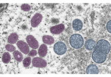 UK monkeypox case numbers show overall decline – GOV.UK