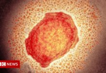 UK to offer mini dose of monkeypox jab amid low stocks – BBC