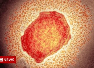 UK to offer mini dose of monkeypox jab amid low stocks – BBC