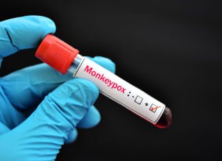 Virginia expands monkeypox vaccine eligibility – Virginia Mercury