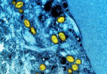 Why it’s important to tell people that monkeypox is predominately affecting gay and bisexual men – The Conversation