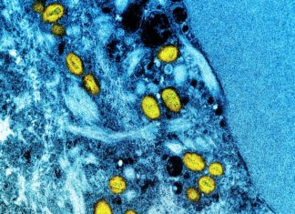 Why it’s important to tell people that monkeypox is predominately affecting gay and bisexual men – The Conversation