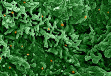 10 key questions about monkeypox the world needs to answer – STAT