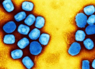 Concern over two cases of monkeypox-related neurological complications in the U.S. – News-Medical.Net