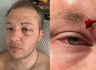 Gay man left with permanent scar after brutal homophobic attack – PinkNews