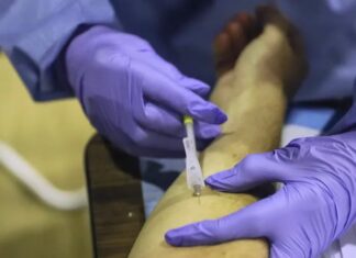 Here’s how to find monkeypox vaccines in Philly, Pa., N.J. – The Philadelphia Inquirer