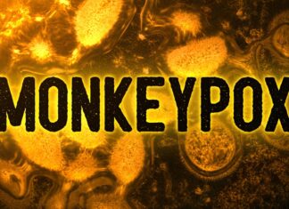LA County Health Dept., CDC Confirm first death in county due to monkeypox – kuna noticias y kuna radio