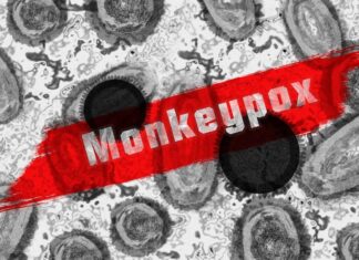 Legacy Health Plans Free Monkeypox Vaccine Clinic In Portland On Saturday – The Lund Report