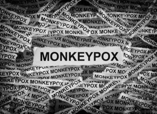 Michigan Health Experts on Why Claiming That Monkeypox Is a ‘Gay Disease’ Could ‘Cause More Harm in the End’ – pride source.com