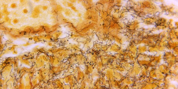 ‘Out of control’ STD situation prompts call for changes - WIBW