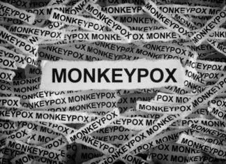 Percentage of gay D.C. monkeypox cases rises slightly – Washington Blade