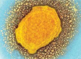 Pilot program intends to address inequities in accessing monkeypox vaccines – News-Medical.Net